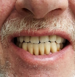 Tænder efter samarbejde med tandteknikker nær Skanderborg