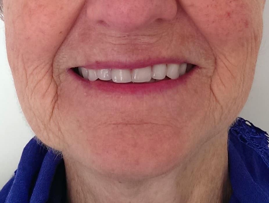 Efter gennemgang af klinisk tandteknikker