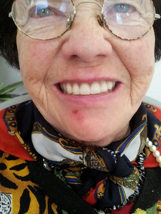Tænder efter arbejde med tandteknikker i Skanderborg